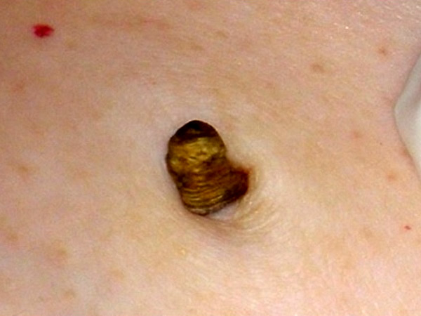 ������ ��� 1 - ��