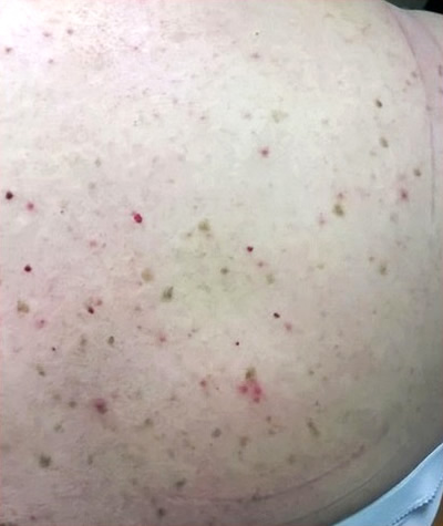 ���������� ������� 2 - ��