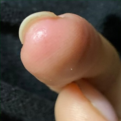 ��������� 2 - �����