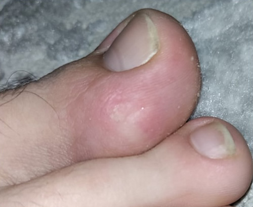 ��������� 5 - �����