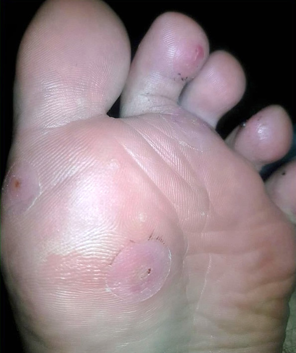��������� 8 - �����